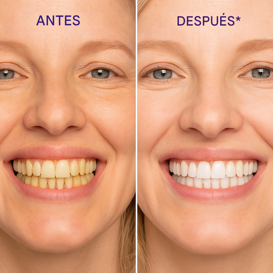 Tiras Blanqueadoras de Künova - Sin peróxido: sonrisa más blanca sin sensibilidad.