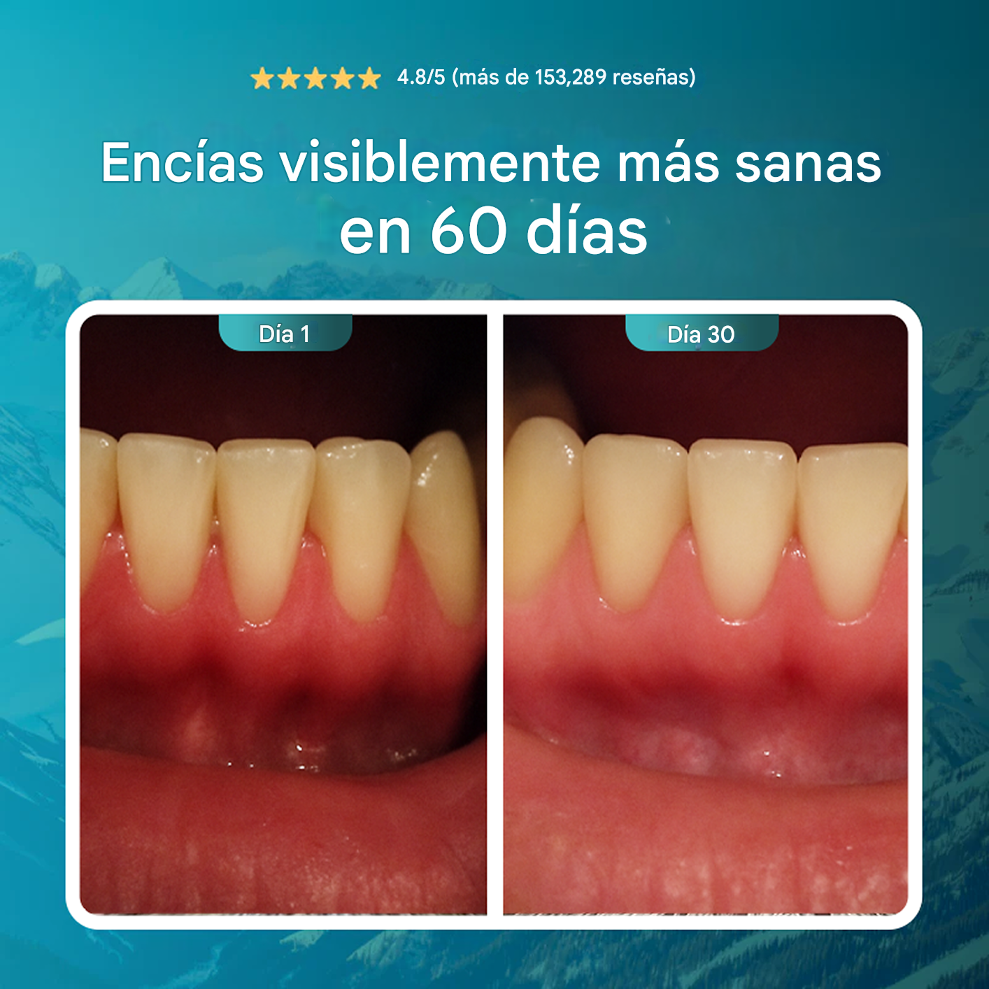 Chicle Remineralizante - Adiós sangrado de encías