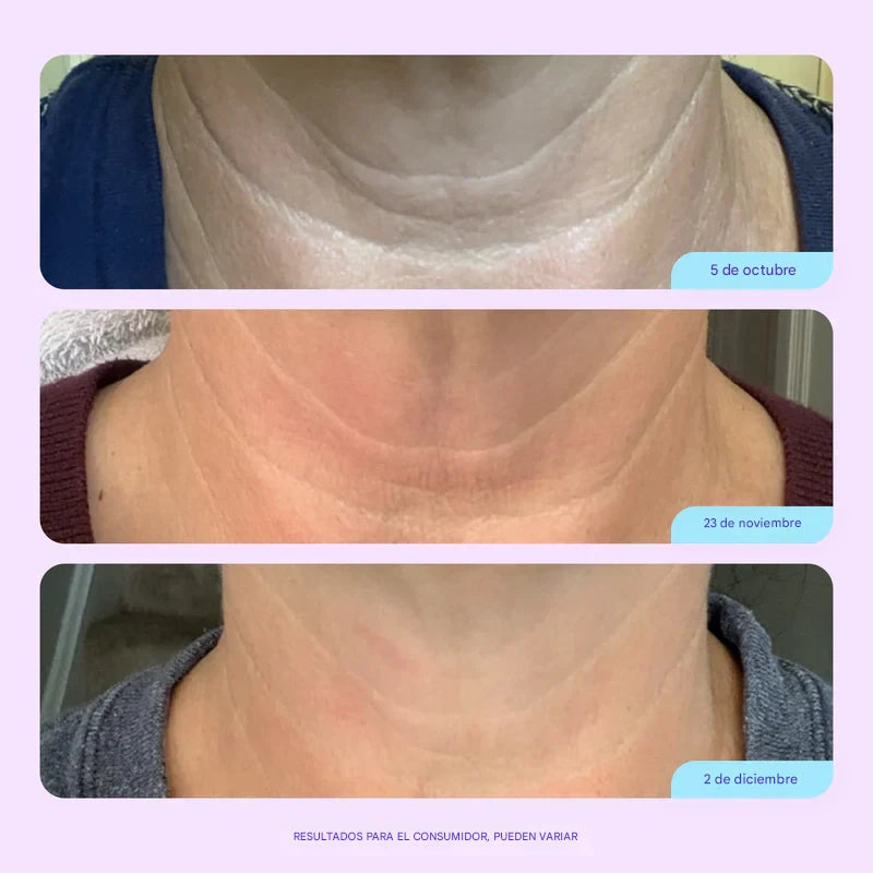 Crema Tensora Cuello & Papada - Adiós arrugas, flacidez y “cuello de pavo” en 4 semanas.