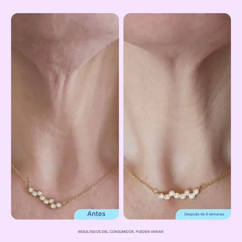 Crema Tensora Cuello & Papada - Adiós arrugas, flacidez y “cuello de pavo” en 4 semanas.